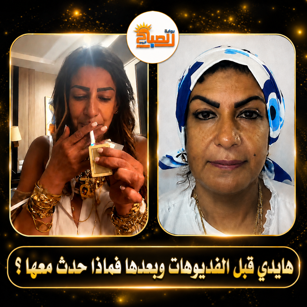 هايدي قبل الفديبوهات وبعدها