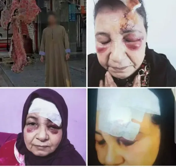 جزار شاب يعتدي علي مسنة  في القنطرة غرب بالإسماعيلية بسبب خلاف مالي