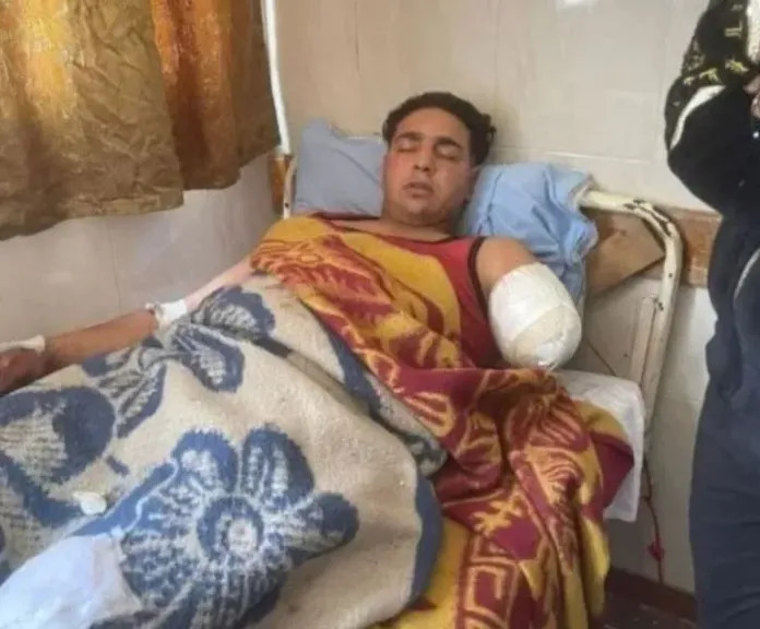 محمد ضحية النمر الأبيض في سيرك طنطا يطالب بدية شرعية تعادل 50 ناقة..