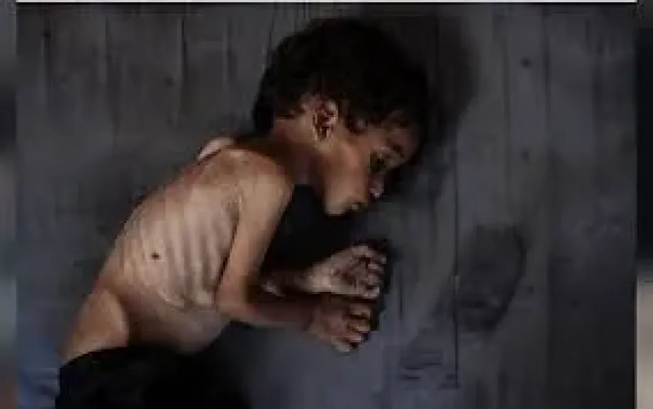 مجاعة كارثية تهدد غزة.. وتحذير طبي من صمت العالم المريب!