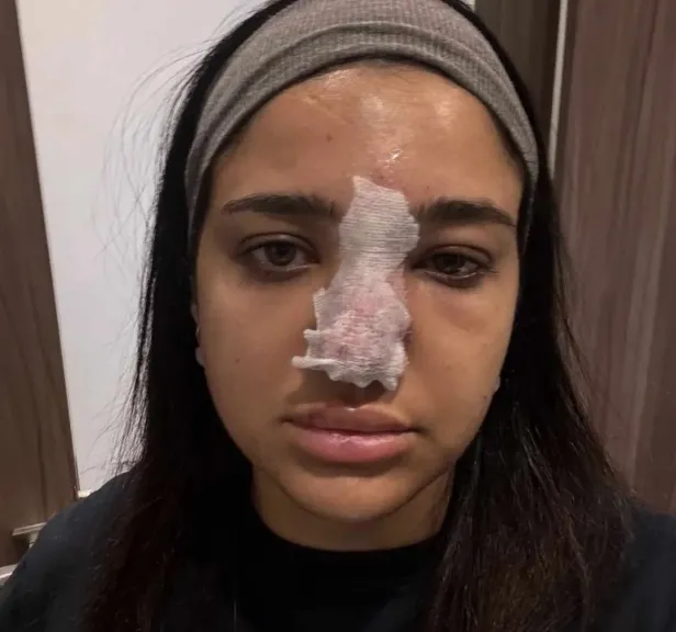 بعد حقنة فيلر.. البلوجر كنزي مدبولي تواجه مضاعفات تهدد حياتها البصرية