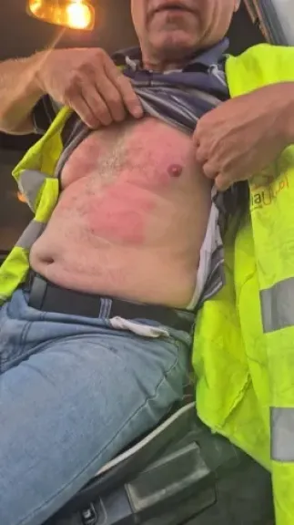 بالصور :الجيش الإسرائيلي يعتدي على 60 سائقًا فلسطينيًا لشاحنات المساعدات القادمة من الأردن