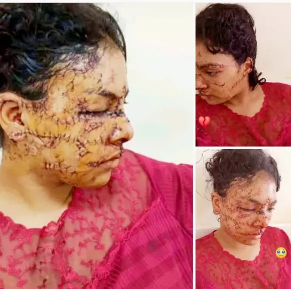 مأساة إيمان.. ضحية الاغتصاب  تزوجت مغتصبها وتعرضت للتشويه والعنف 6 سنين