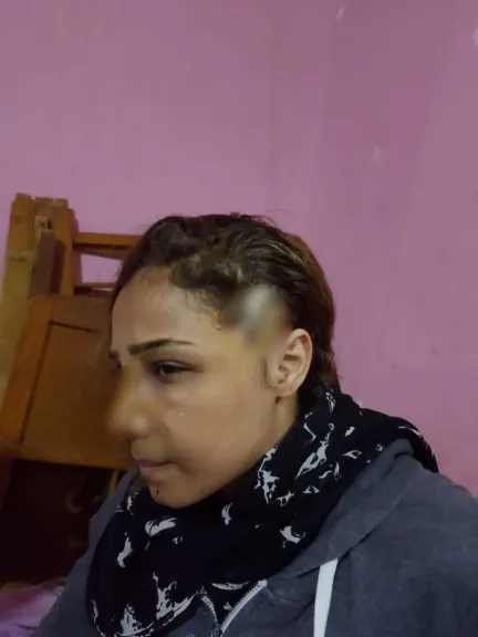 ”شوّه وجهي وفضحني بالصور”.. منار تكشف تفاصيل الاعتداء الصادم من طليقها بأكتوبر