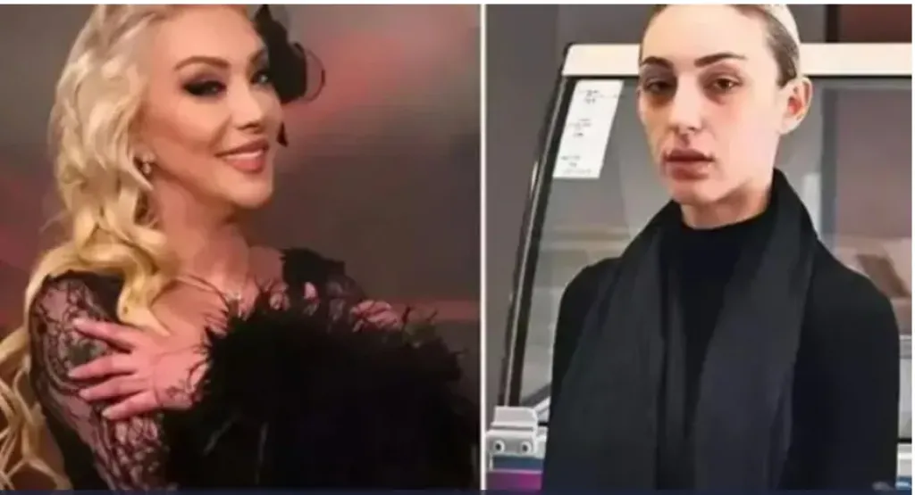 أعتقال ابنة المغنية التركية غوللو وصديقتها بتهمة القتل العمد بعد سقوط الفنانة من الطابق الخامس