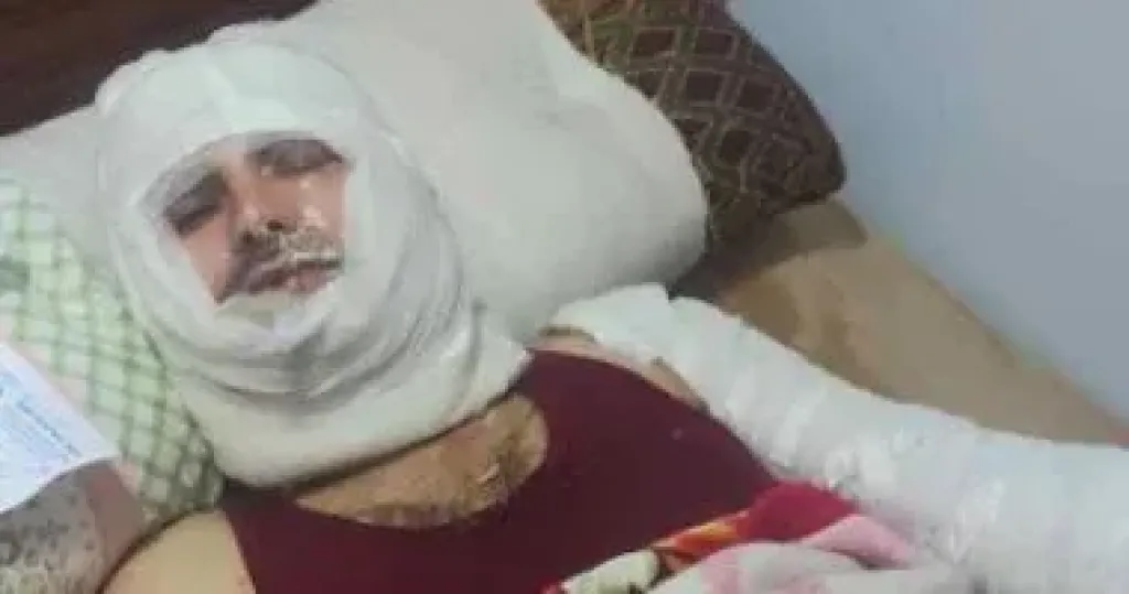 ضبط متهمين بإشعال النيران في مواطن داخل منزله في كفر الشيخ