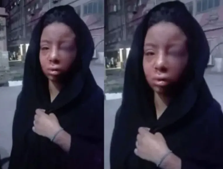 جريمة بلبيس المؤلمة  المجرم حاول قلع عيون ضخيتة الطفلة  حتي لاتتعرف علية