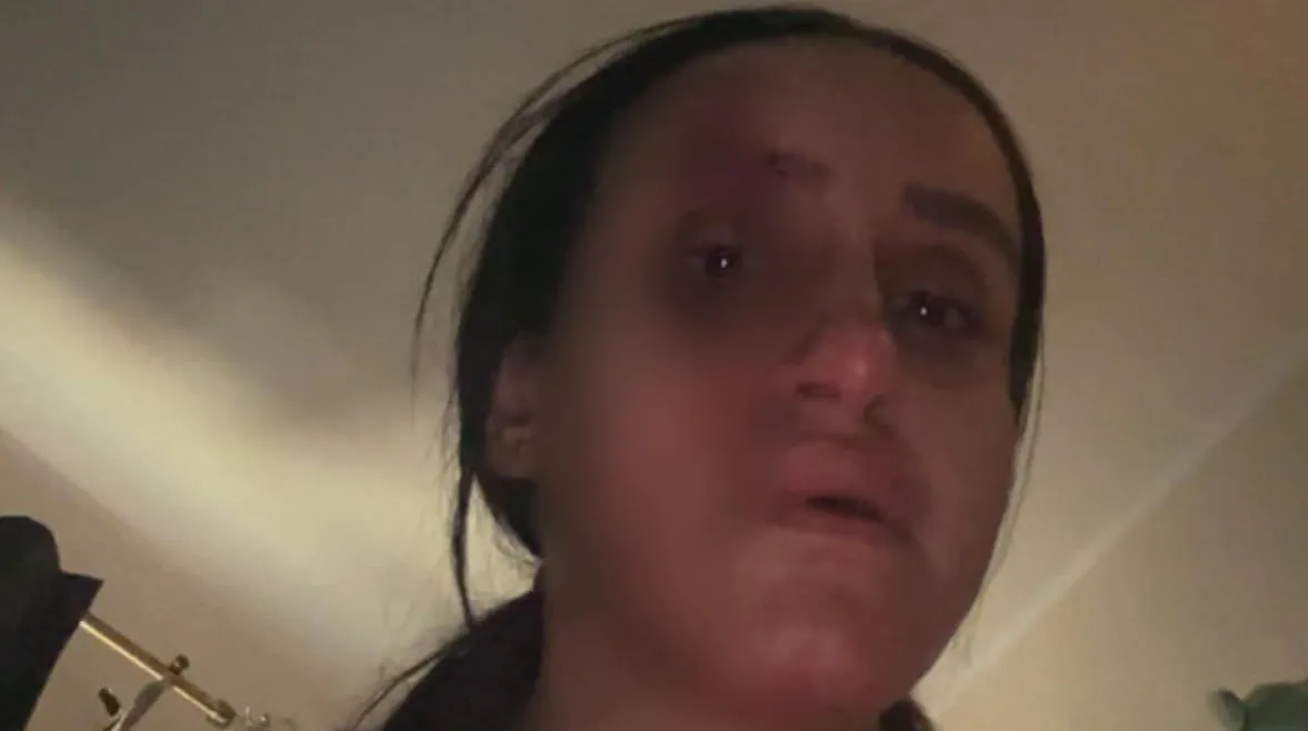 17 سنة من الجحيم.. ضحية البراجيل تكشف مأساة عنف أسري صادمة