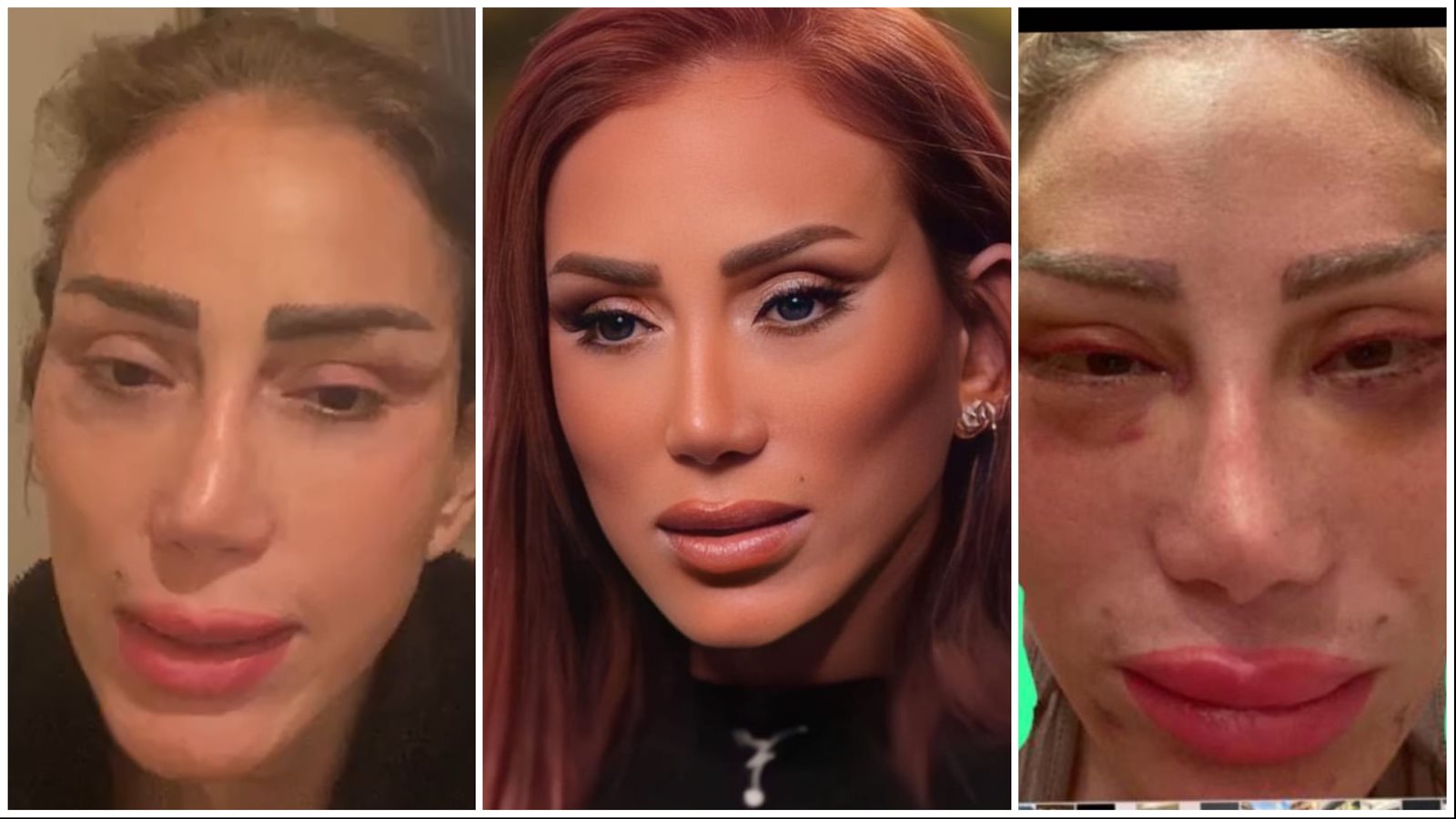 كنت قمر وبوظ الناس بلبنان»| "خناقة" ريهام سعيد وطبيب التجميل تصل إلى  القضاء.. ماذا قال؟