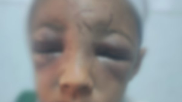 وحشية أب بالمحلة الكبرى..أب يعتدي بالضرب على طفله بسبب 10 جنيهات