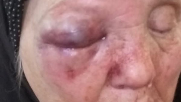 اعتداء صادم.. الابن يضرب والدته العجوز ويرشقها بالألفاظ البذيئة