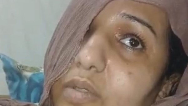 رعب نهار رمضان.. زوج يعتدي على زوجته بسلاح حاد في طنطا