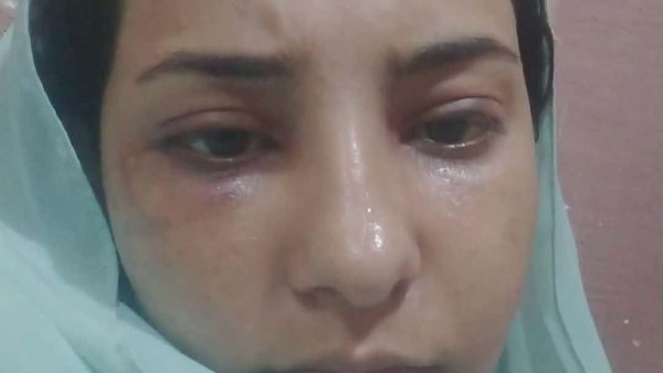 بسبب زيارة والدتها.. فتاة تتهم والدها بالاعتداء عليها ومحاولة قتلها في الغربية