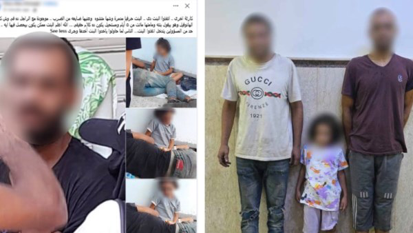 بسبب أموال التسول.. ضبط رجل اعتدى بالضرب على طفلة 5 سنوات بالإسكندرية