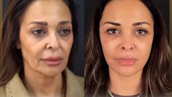 «تفتكروا هصغر كام سنة؟».. داليا البحيري تكشف خضوعها لعملية تجميل وتفاصيل النتيجة