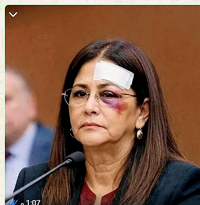 زوجة مادورو في السجون الأمريكية: كدمات غامضة وأسئلة حقوقية بلا إجابات