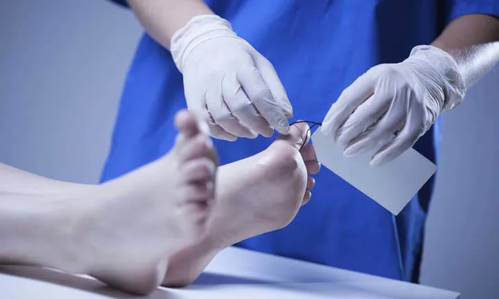 رائحة غامضة تكشف المأساة.. العثور على جثة مسن متحللة داخل منزله بالبحيرة